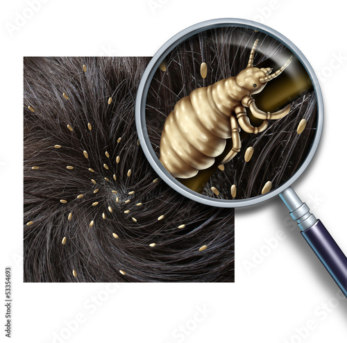 Illustration: Lice Problem Lice Problem