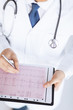 male doctor hands with cardiogram