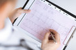 male doctor hands with cardiogram