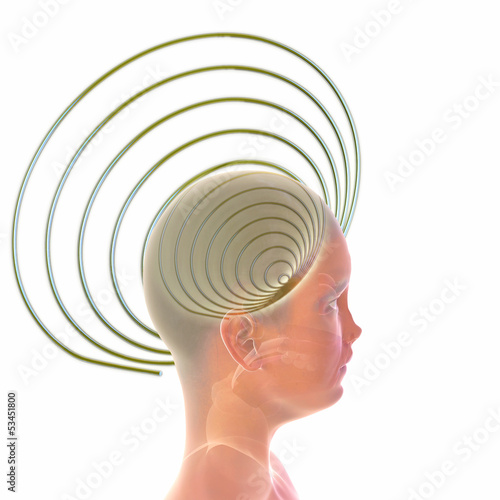 Illustration: Ultraschall Therapie - 3D Render Ultraschall Therapie - 3D Render