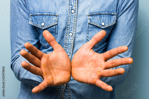 Photo: Blue collar worker showing his palms Blue collar worker showing his palms