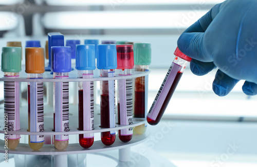 Photo: Blood tubes for centrifuging Blood tubes for centrifuging