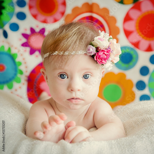 Photo: cheerful little baby girl with Downs Syndrome cheerful little baby girl with Downs Syndrome