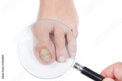 Photo: Doctor dermatologist examines the nail on the presence of the fu Doctor dermatologist examines the nail on the presence of the fu