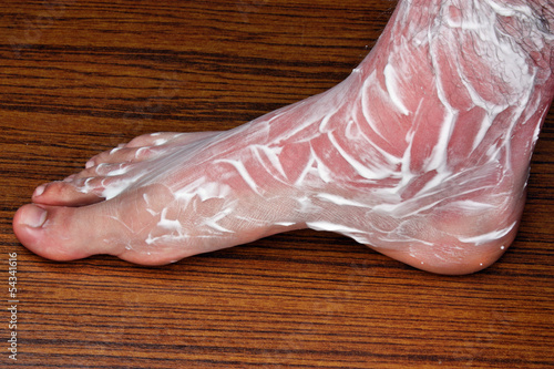 Photo: Treatment of sunburn Treatment of sunburn