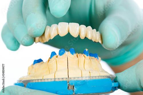 Photo: Porcelain teeth - dental bridge Porcelain teeth - dental bridge
