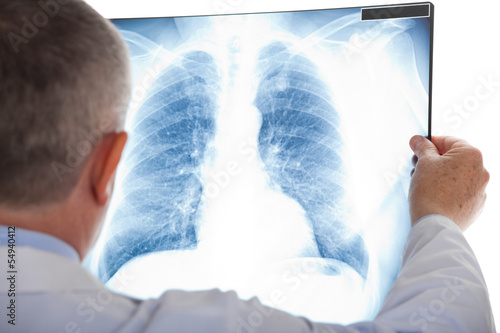 Photo: Doctor examining a lung radiography Doctor examining a lung radiography