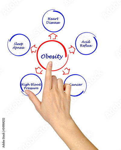 Photo: Obesity Obesity
