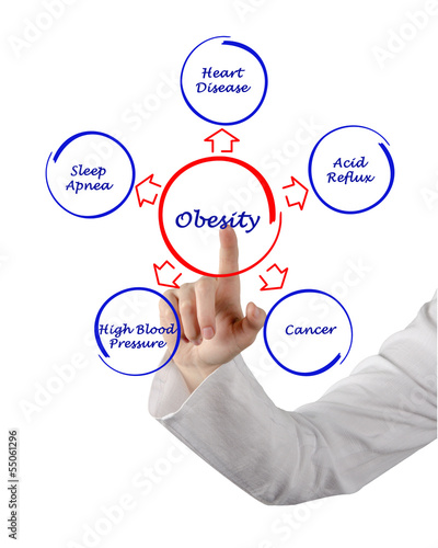 Photo: Obesity Obesity