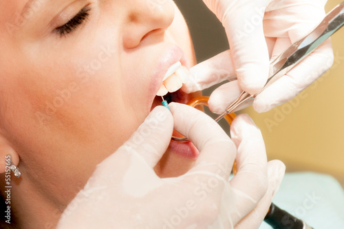 Photo: Needle in the tooth Needle in the tooth