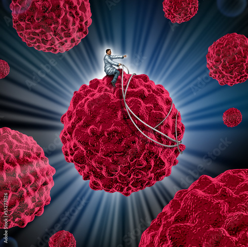 Illustration: Cancer Management Cancer Management