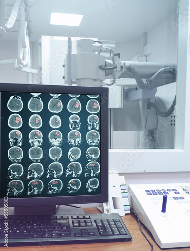 Photo: CT scan on the monitor in the X-ray lab CT scan on the monitor in the X-ray lab