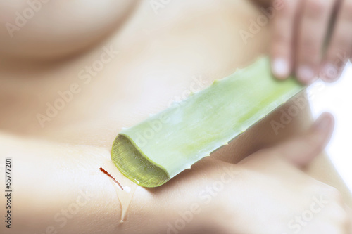 Photo: Frau benutzt Aloe Vera Gel Frau benutzt Aloe Vera Gel