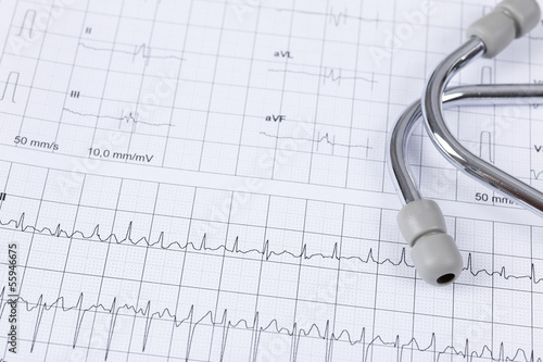 Photo: Cardiogram pulse trace and a stethoscope Cardiogram pulse trace and a stethoscope