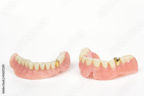 Photo: alte Prothesen mit Goldverzierungen alte Prothesen mit Goldverzierungen