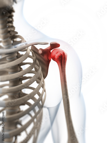 Illustration: 3d rendered illustration of a painful shoulder 3d rendered illustration of a painful shoulder