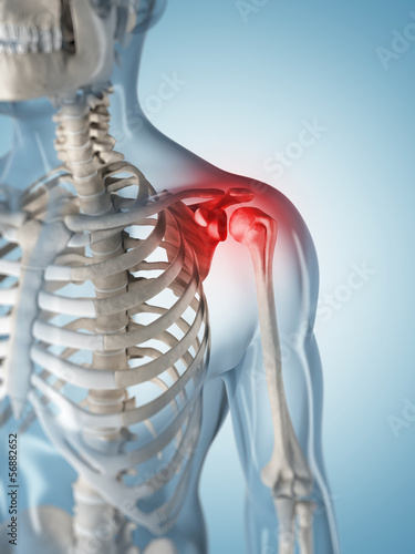 Illustration: 3d rendered illustration of a painful shoulder 3d rendered illustration of a painful shoulder