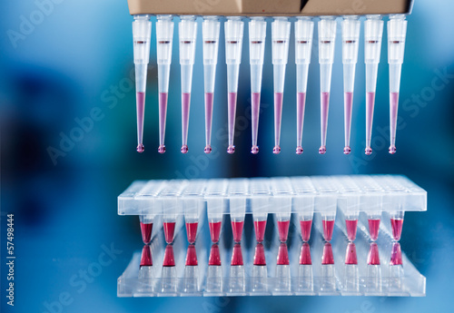 Photo: Paternity test method of genetic analysis Paternity test method of genetic analysis
