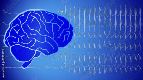 Vector: Brain Wallpaper EEG Neurology Brain Wallpaper EEG Neurology
