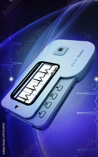Illustration: ECG ECG