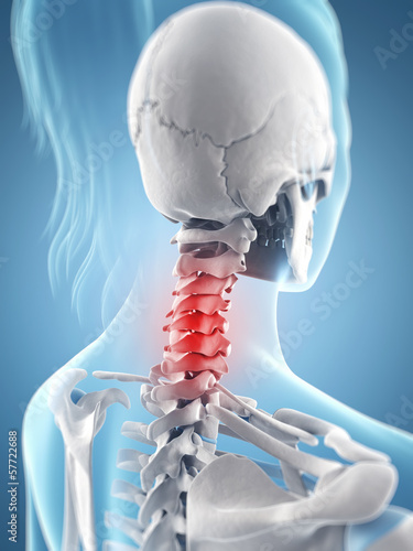 Illustration: inflamed neck inflamed neck