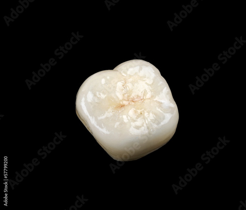 Photo: Ceramic crown Ceramic crown
