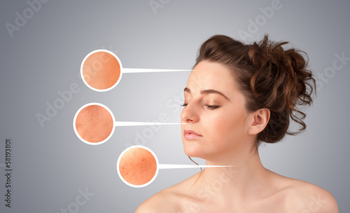 Photo: Beautiful young girl with facial care arrow signs of damaged ski Beautiful young girl with facial care arrow signs of damaged ski