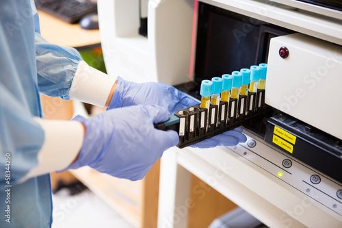 Photo: Coagulation Test Analysis Coagulation Test Analysis