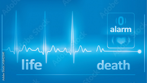 Illustration: heart beats cardiogram and asystole on the medical monitor heart beats cardiogram and asystole on the medical monitor