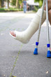 Young girl with broken leg on crutches Young girl with broken leg on crutches