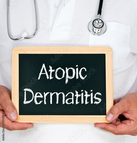 Photo: Atopic Dermatitis Atopic Dermatitis