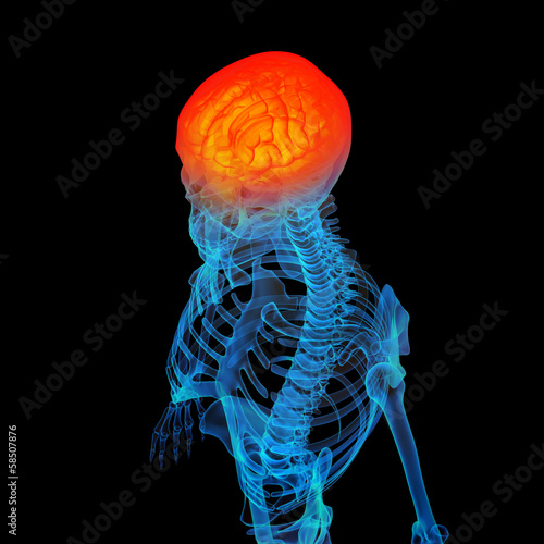 Illustration: 3d rendered human of head pain 3d rendered human of head pain
