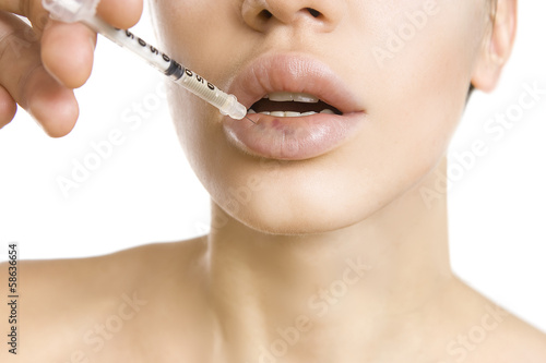 Photo: woman getting an injection - real lip bruise after injection woman getting an injection - real lip bruise after injection