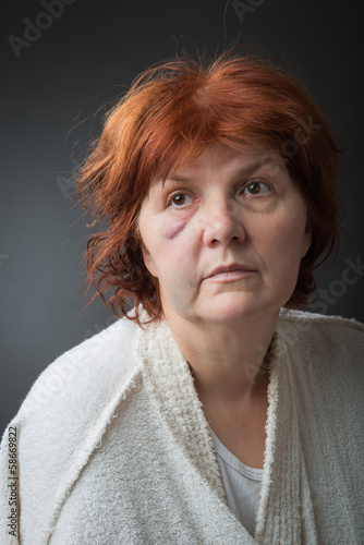 Photo: Abused woman Abused woman