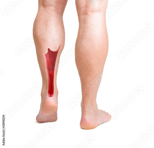 Photo: achilles tendon with lower leg muscles achilles tendon with lower leg muscles