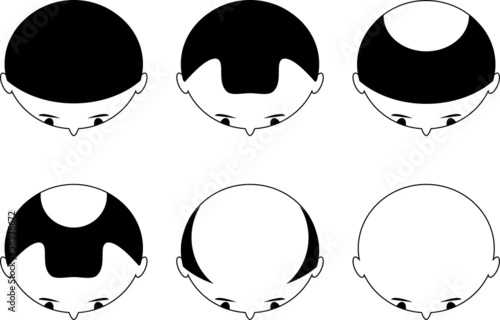 Vector: 脱毛 脱毛