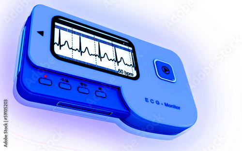 Illustration: ECG ECG