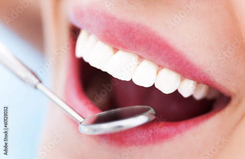 Photo: Woman teeth and a dentist mouth mirror Woman teeth and a dentist mouth mirror