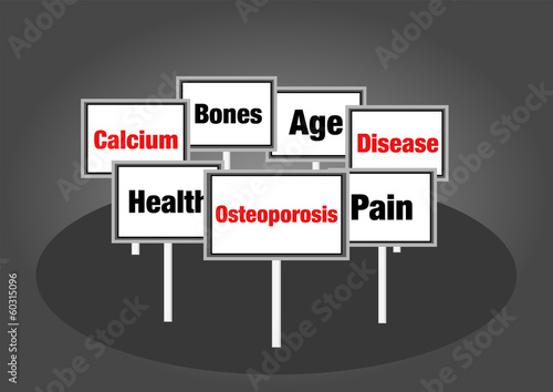 Illustration: Osteoporosis signs Osteoporosis signs