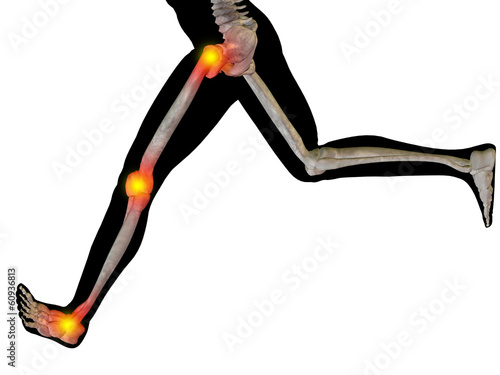 Illustration: Conceptual human pain anatomy Conceptual human pain anatomy