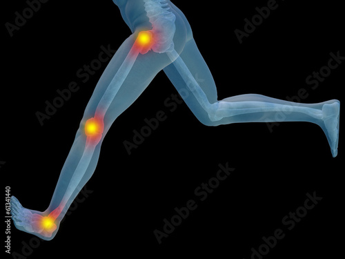 Illustration: Conceptual human pain anatomy Conceptual human pain anatomy