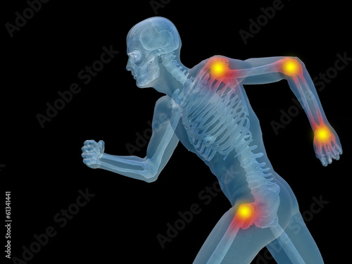 Illustration: Conceptual human pain anatomy Conceptual human pain anatomy