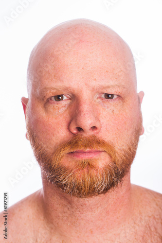 Photo: Bald Man Bald Man