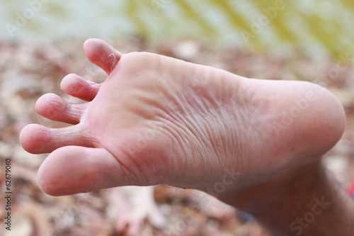 Photo: foot foot
