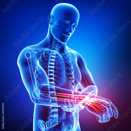 Illustration: Anatomy of male hand pain in blue Anatomy of male hand pain in blue