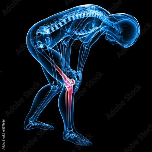 Illustration: Anatomy of female knee pain in black Anatomy of female knee pain in black