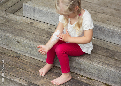 Photo: Girl applying cream on allergic skin, eczema treatment Girl applying cream on allergic skin, eczema treatment
