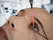 Laser eye surgery on 3D CGI character Laser eye surgery on 3D CGI character