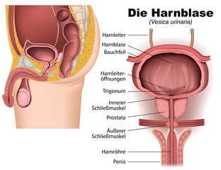 In Vitro Fertilization (IVF)