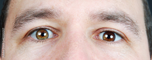 Heterochromia iridum - 82313257
